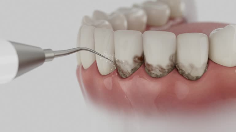 Trusted Wisdom Tooth Removal service in Knob Noster, MO - Dentist Open Now